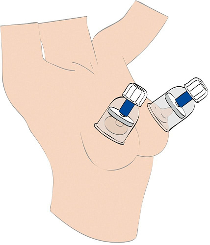 Прозрачные поршневые помпы для сосков Orion BLACK VELVETS  5225620000