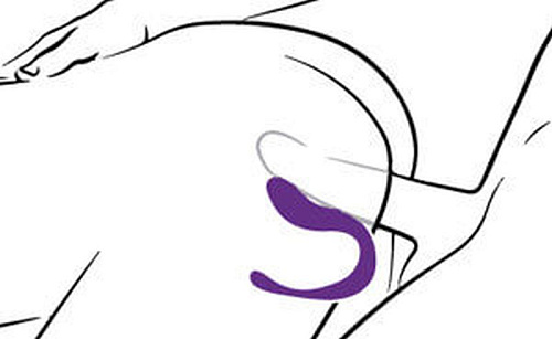 Фиолетовый вибростимулятор для пар с пультом ДУ Adrien Lastic Adrien Lastic Mini Romeo 10943