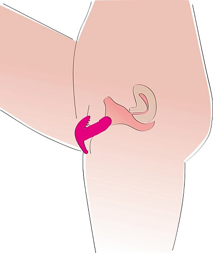 Вибростимулятор с вагинальной пробкой розового цвета Orion My Little Secret 0582131