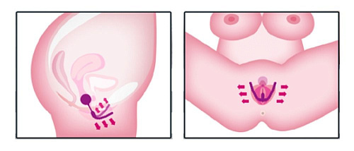 Лиловый тренажёр интимных мышц Orion Intimate Spreader Pussy Gym 05373140000