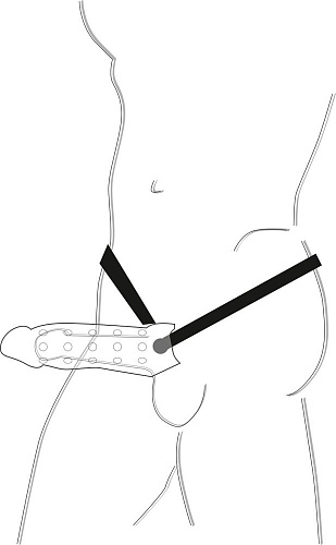 Вибрострапон телесного цвета на ремешках Orion Exstention  0585947